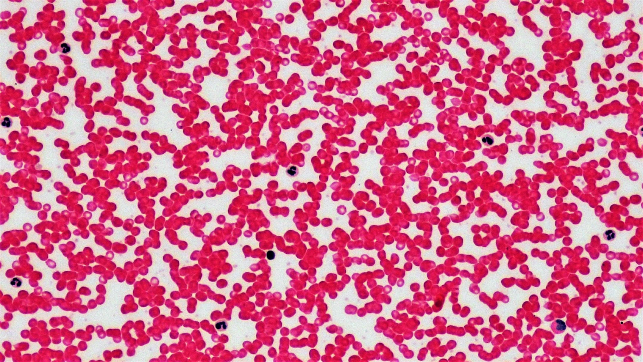 Connective Tissue: Human Blood Leukocyte Survey