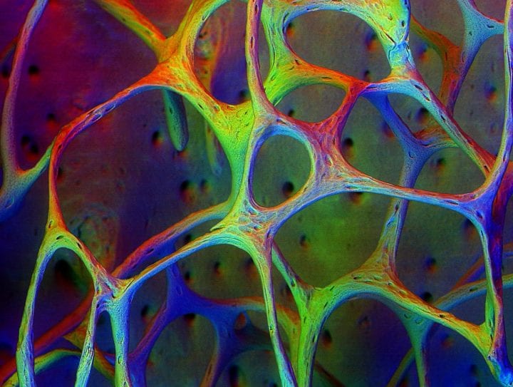 Backscatter SEM of Trabecular Bone