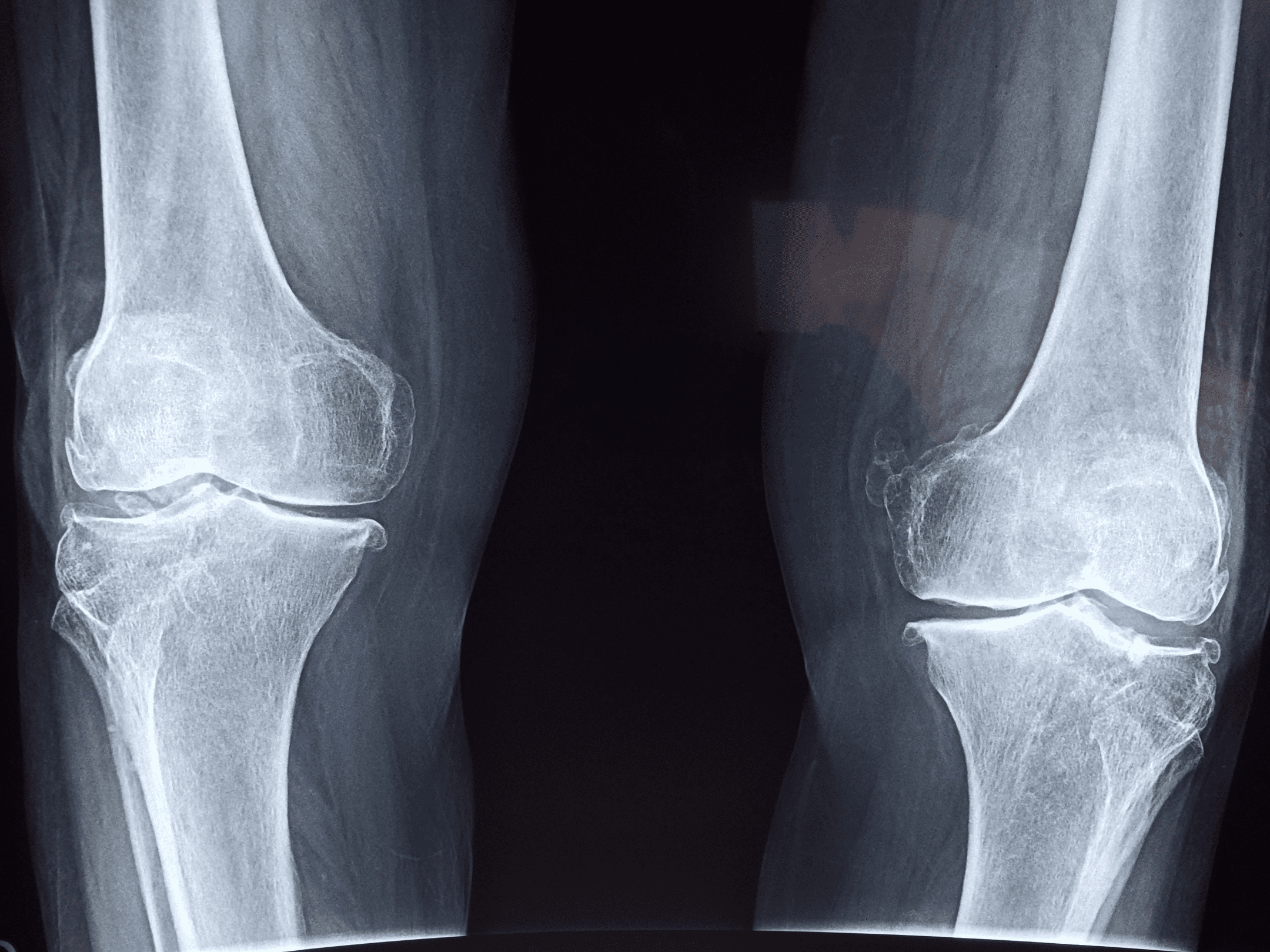 lubricate knee joints naturally Staying Active Starts with Joint Health: Lubrication, Comfort, and the  Natural Support You Need main image 0