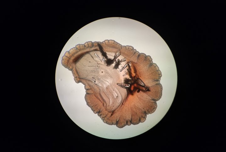 photograph of yeast colony under a microscope
