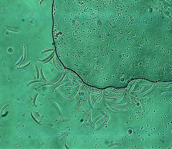 microscopic photo of bacteria in blueish-green water