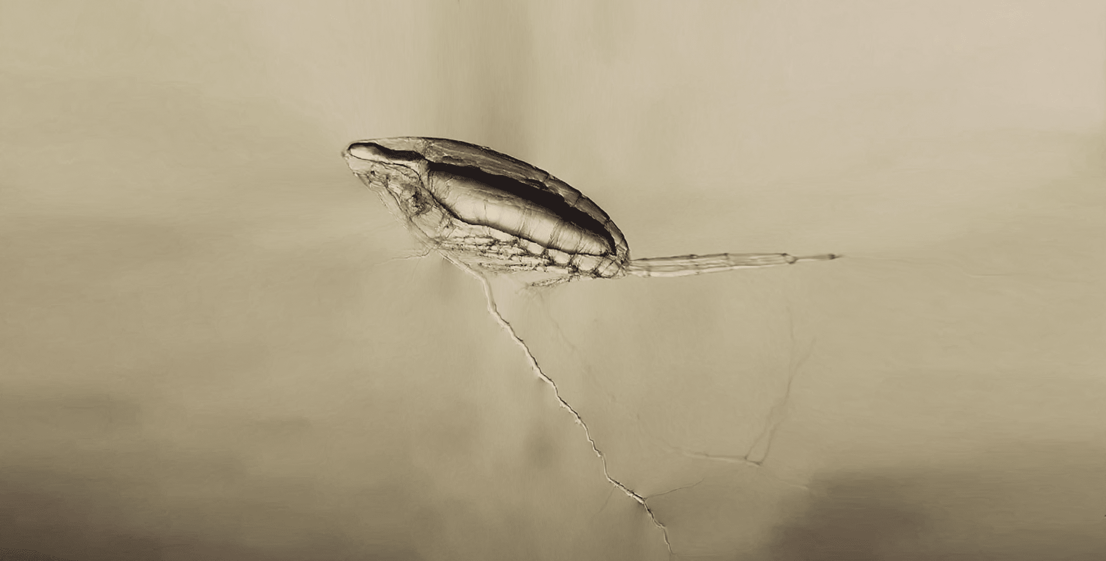 microscopic photograph of aquatic bug
