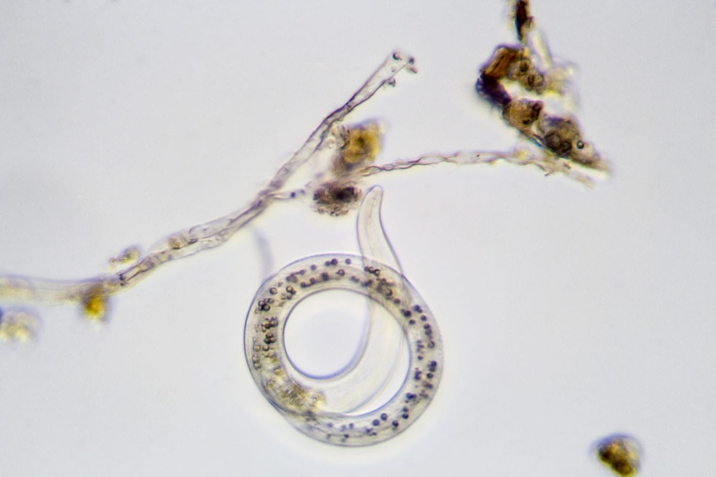 A nematode (magnified 400X)